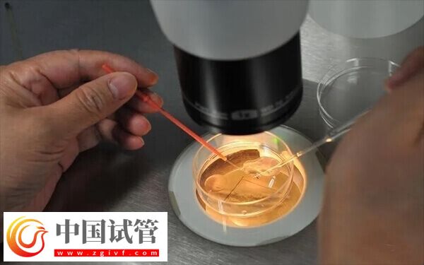 試管前如何調理身體(圖1)