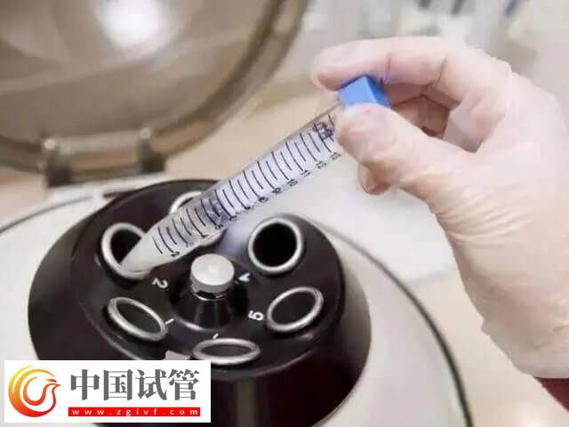 試管睪丸穿刺取精要穿刺幾次(圖2)