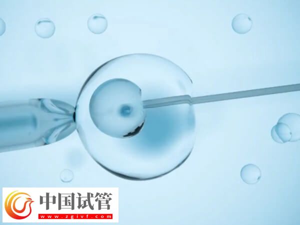 試管睪丸穿刺取精要穿刺幾次(圖1)