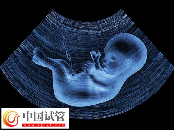 實施試管懷孕4個月穩不穩定(圖3)