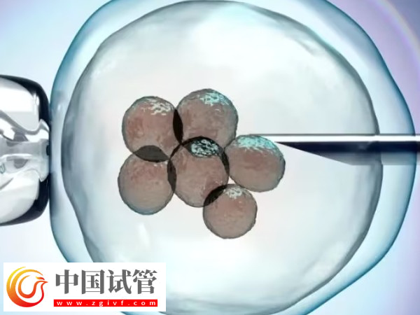 湘雅和武漢試管哪家好(圖1) 湘雅和武漢試管哪家好(圖1)