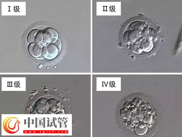 南昌婦幼做試管醫(yī)生排名(圖2) 南昌婦幼做試管醫(yī)生排名(圖2)