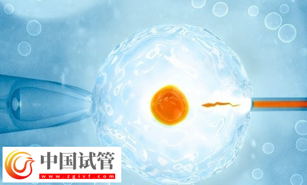 杭州醫保試管是否報銷(圖1)