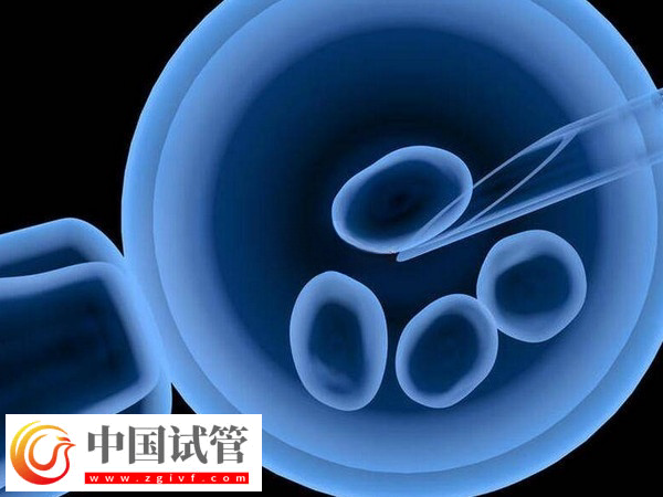 杭州省婦保醫(yī)院和市一醫(yī)院做試管哪個(gè)好(圖3) 杭州省婦保醫(yī)院和市一醫(yī)院做試管哪個(gè)好(圖3)