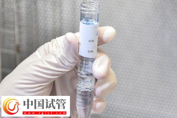 高齡試管嬰兒容不容易畸形(圖1)