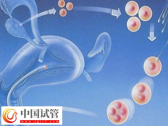 試管嬰兒不適用于哪些人(圖1)