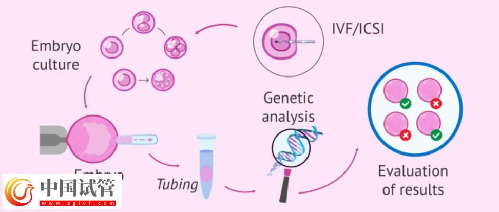 基因與第三代試管嬰兒的結合(圖1)