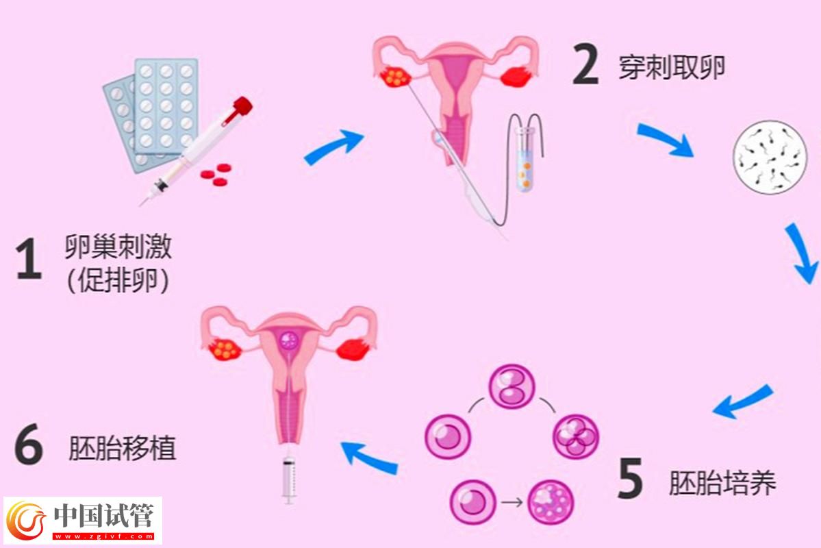 試管嬰兒從取卵到胚胎移植的完整流程(圖2)