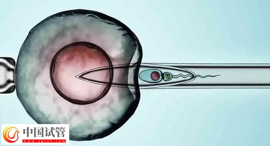 濟南做試管嬰兒成功率較高的醫院前三名：濟南第一人民醫院排第一(圖3)