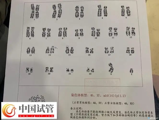 廣州做染色體檢查多少錢?廣東省婦幼保健院約230-3300元左右(圖2) 廣州做染色體檢查多少錢?廣東省婦幼保健院約230-3300元左右(圖2)