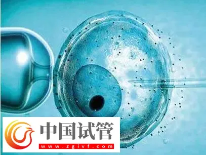 北京做供卵試管不用排隊的醫院有哪些？這些公立醫院紛紛上榜(圖3)