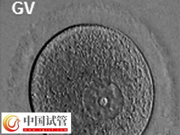 女性FSH高怎樣才能降下來(圖2)