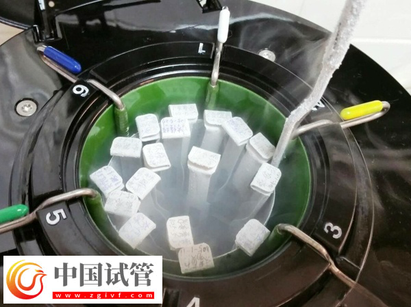 女性fsh高做試管能不能配出高質量胚胎(圖1)