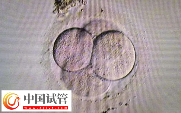 女性fsh高做試管能不能配出高質量胚胎(圖3)