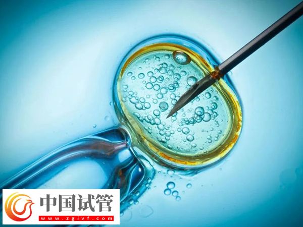 女性fsh高做試管能采用哪些方案(圖1)