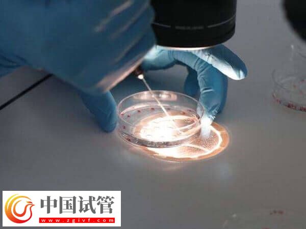 養囊成功率和什么有關(圖1)