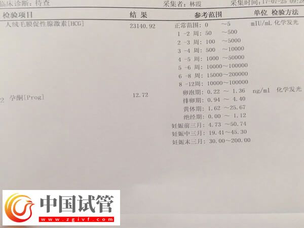 試管不著床有什么征兆(圖1) 試管不著床有什么征兆(圖1)