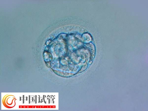 胚胎移植后哪些反應是著床了(圖1)