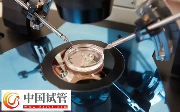 試管移植當天需要注意什么(圖1)