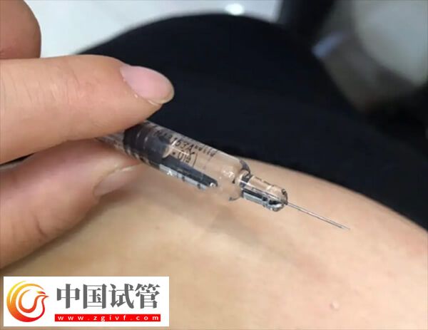 試管嬰兒長(zhǎng)方案和短方案哪個(gè)好(圖1) 試管嬰兒長(zhǎng)方案和短方案哪個(gè)好(圖1)