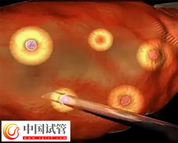 前往長沙做三代試管生孩子多少錢(圖3)