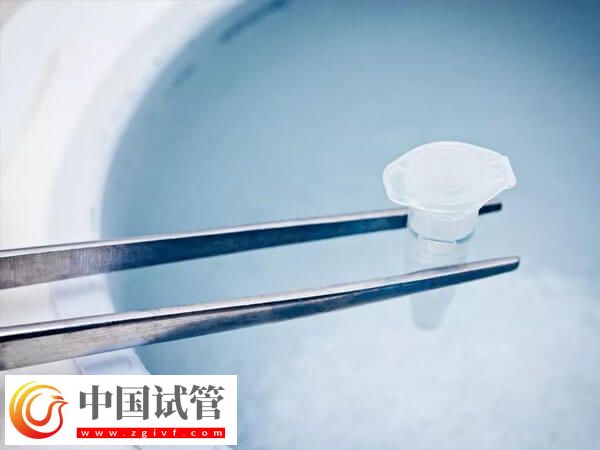 試管凍精費用是多少(圖2)