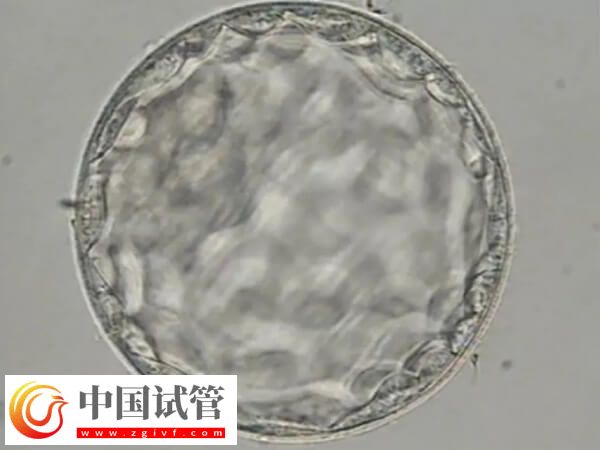 胚胎質量一般是移植還是促排好(圖1)