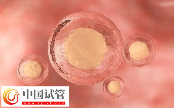 普通促排和試管促排哪個(gè)好(圖1)