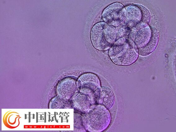 試管嬰兒什么情況下養囊(圖1)