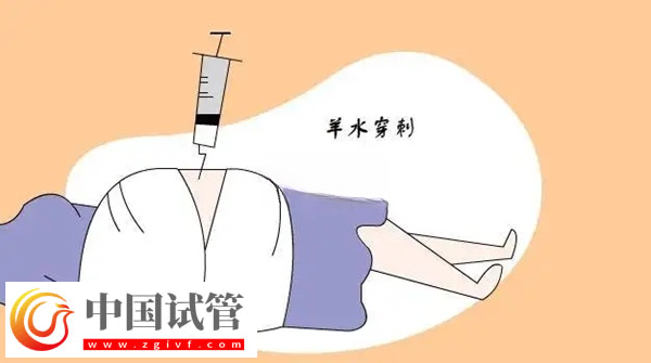 申請供精試管懷孕必須要查羊穿(圖1)