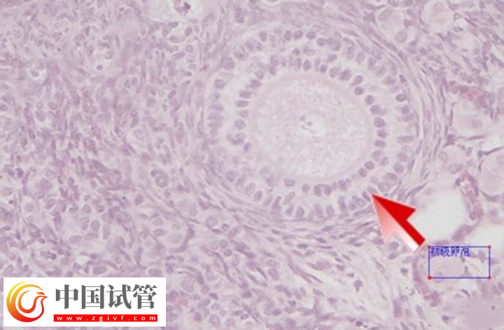 在美國做試管卵泡監測幾次能成功(圖2)