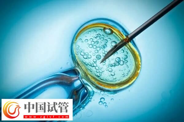 DNAAF2基因突變是什么情況(圖3) DNAAF2基因突變是什么情況(圖3)