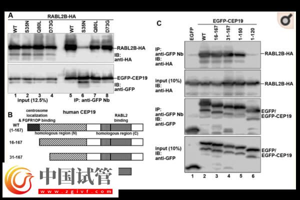 CEP19基因缺陷應(yīng)該怎么處理(圖1)