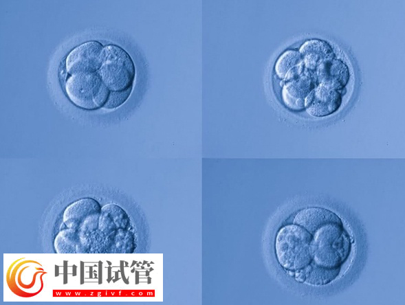 試管嬰兒fet移植成功率是多少(圖1) 試管嬰兒fet移植成功率是多少(圖1)