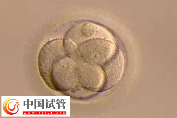 試管原腸胚能不能進行胚胎移植手術(圖1)