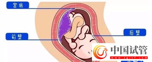 1分鐘了解胎盤前壁和后壁的3大區別，為孕期做好準備(圖2)