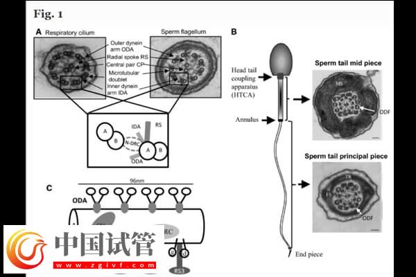 CCDC39基因突變能不能做試管(圖1)