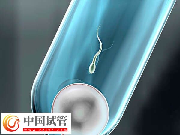 什么會影響試管嬰兒成功率(圖2) 什么會影響試管嬰兒成功率(圖2)