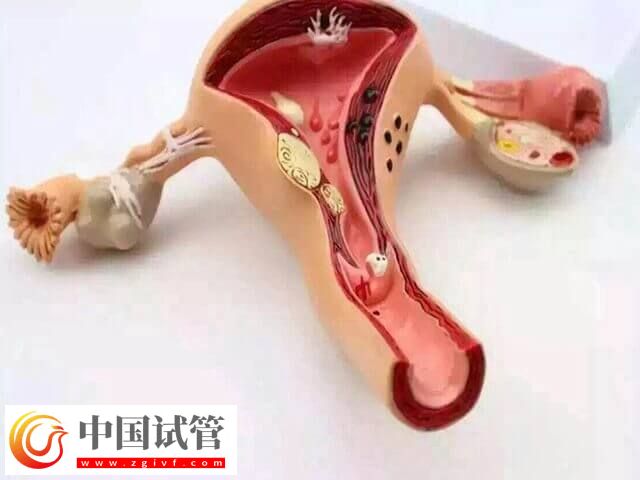 什么會影響試管嬰兒成功率(圖1) 什么會影響試管嬰兒成功率(圖1)