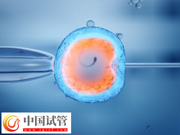 浙大一院試管嬰兒好不好(圖1)