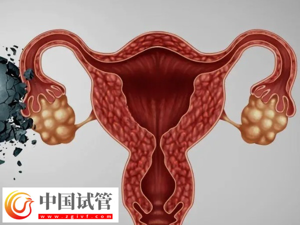 夫妻去美國(guó)做試管怎么選擇醫(yī)院(圖5)