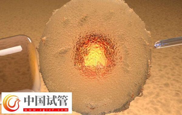 三代試管PGD技術檢測是否必須養囊(圖2)