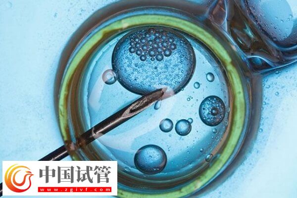 做試管對amh值有沒有要求(圖1)