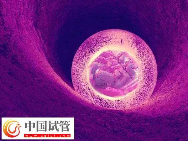 子宮憩室影不影響試管移植(圖2)