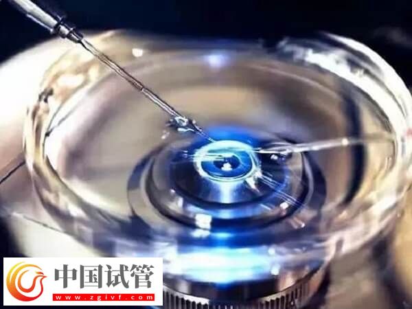 3bc的凍囊胚質(zhì)量好不好(圖2) 3bc的凍囊胚質(zhì)量好不好(圖2)