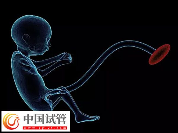 試管出生雙胞胎的健康與什么有關(圖1)