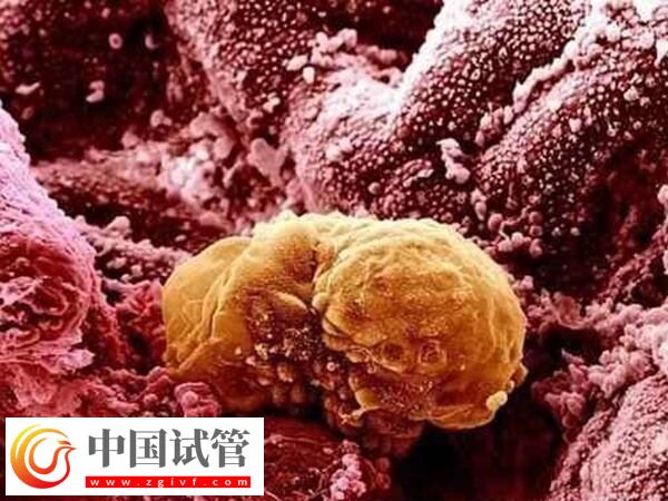 卵巢早衰amh值0.08試管能不能成功(圖1)