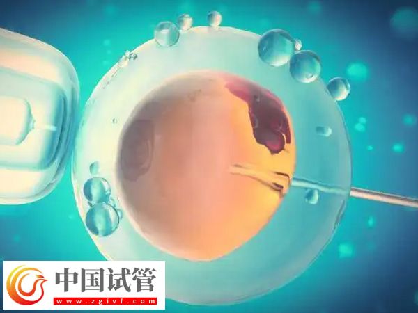 身高153做試管能不能要雙胞胎(圖1)