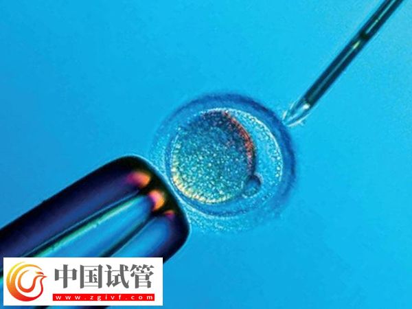 身高153做試管能不能要雙胞胎(圖2)