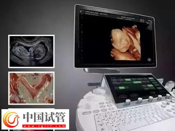 鷹潭公立三甲醫院做一次四維彩超多少錢？(圖1)